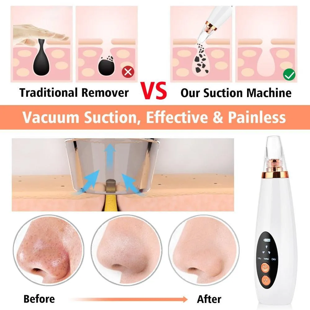 Facial Pore Cleaner Blackhead Remover Vacuum Suction Cleaner Pore Acne