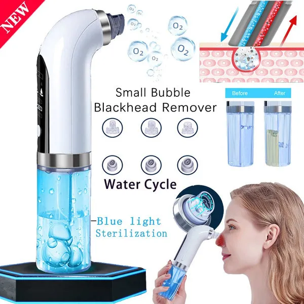 Moisturizing Blackhead Remover