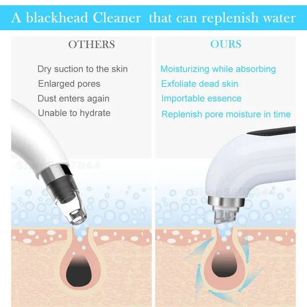 Moisturizing Blackhead Remover